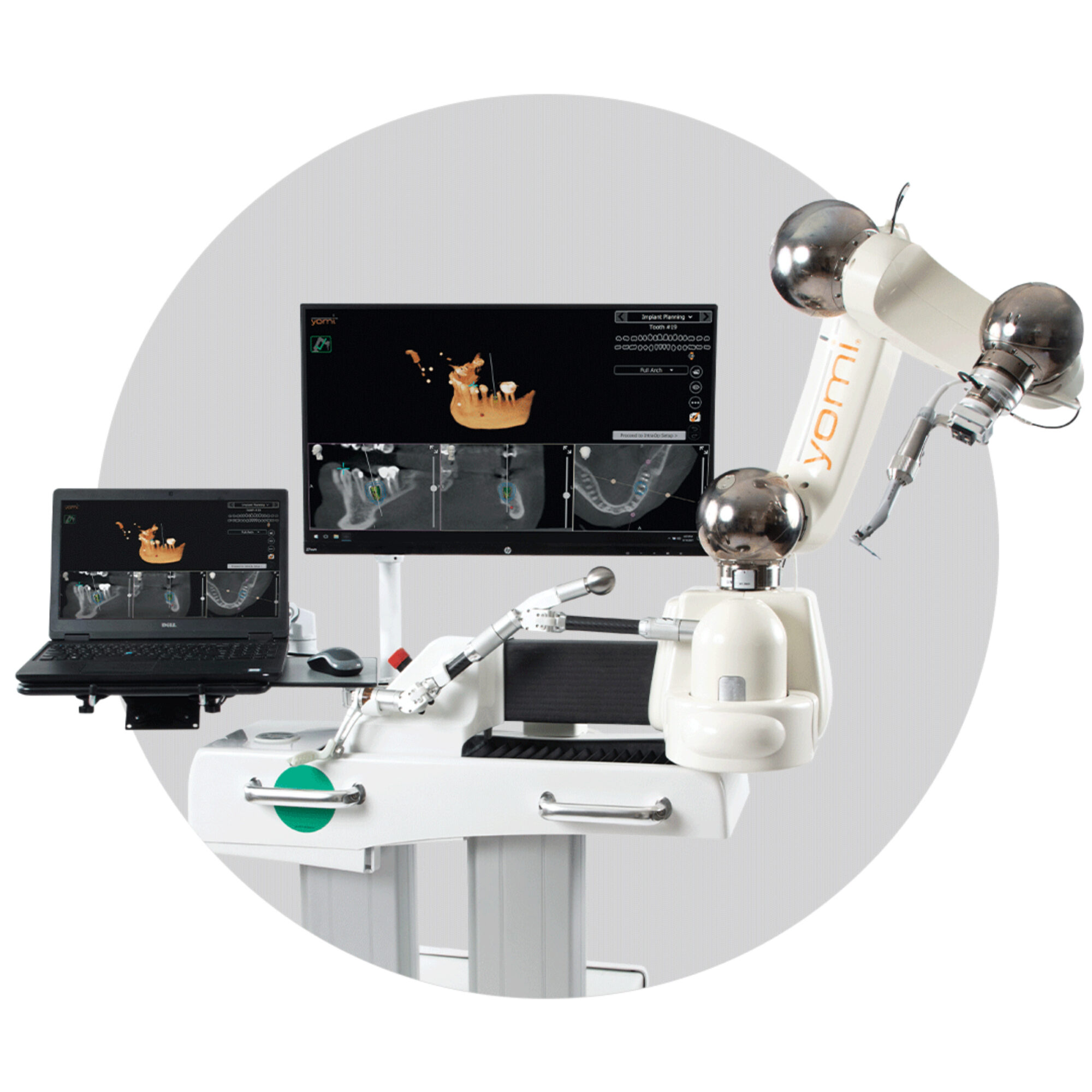 Yomi® robotic system for precise dental implant placement, featuring a computer interface and advanced imaging technology, highlighting robot-assisted dentistry at Caring Family Dentistry in Concord.